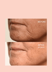 Theorem Serum Boost – Skin Revitalizing Treatment