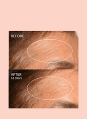 Theorem Serum Boost – Skin Revitalizing Treatment